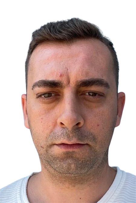 MURAT YILMAZ